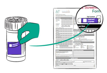 Sample handling final steps