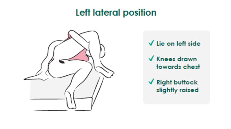 left lateral position